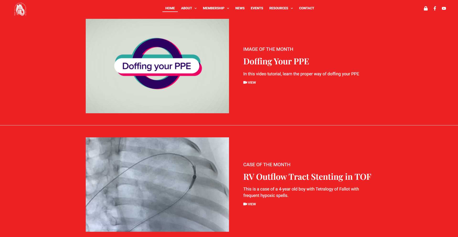 PSCCI homepage Image of the Month block for 'Doffing Your PPE' and Case of the Month block for RV outflow tract stenting, both on a red background